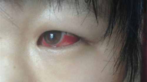 光觸媒除甲醛保護新裝修教室空氣，更保護孩子們