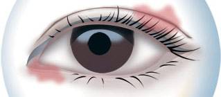 CBA***得分手發(fā)高燒吸氧0得分 教練：賓館房間新裝修，甲醛中毒導(dǎo)致的！