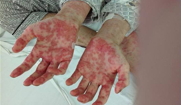 室內甲醛檢測治理，你不得不需要了解的三點！