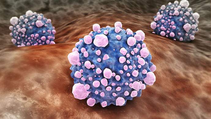 平時(shí)不注意甲醛超標(biāo)，50歲女子劇烈頭痛、惡心干嘔，一查已是癌癥晚期！