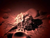 癌癥、白血病越來越多，是因為時代在進(jìn)步而導(dǎo)致的嗎？