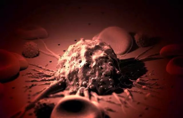 癌癥、白血病越來(lái)越多，是因?yàn)闀r(shí)代在進(jìn)步而導(dǎo)致的嗎？